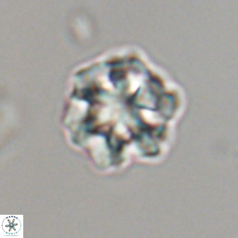 Olladiscoaster perplexus 32596