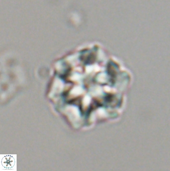 Olladiscoaster perplexus 32599
