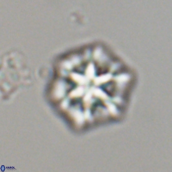 Olladiscoaster perplexus 32600