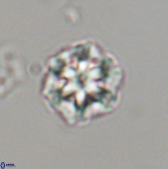 Olladiscoaster perplexus 32601