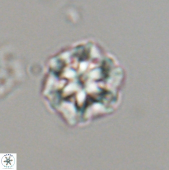 Olladiscoaster perplexus 32601
