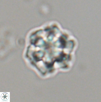 Olladiscoaster perplexus 32602
