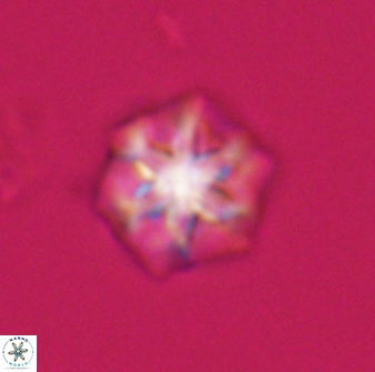 Olladiscoaster perplexus 32603