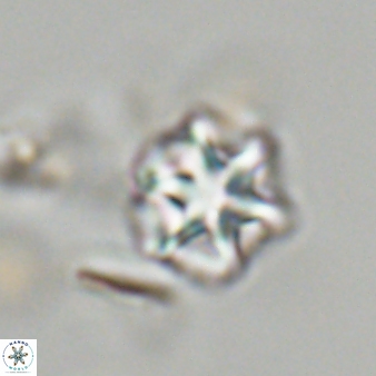 Olladiscoaster perplexus 32673