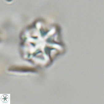 Olladiscoaster perplexus 32675