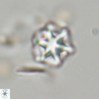 Olladiscoaster perplexus 32680