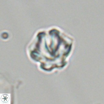Olladiscoaster perplexus 32681