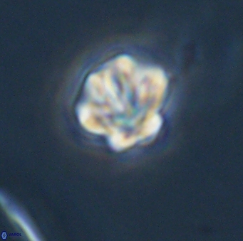 Olladiscoaster perplexus 32683