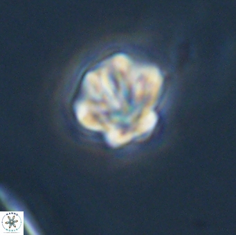 Olladiscoaster perplexus 32683