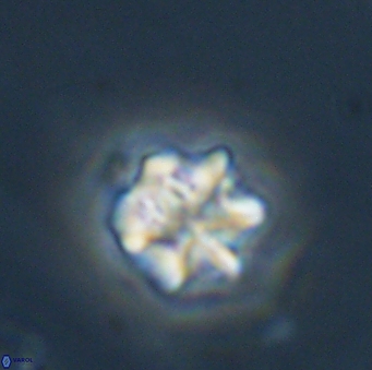 Olladiscoaster perplexus 32688