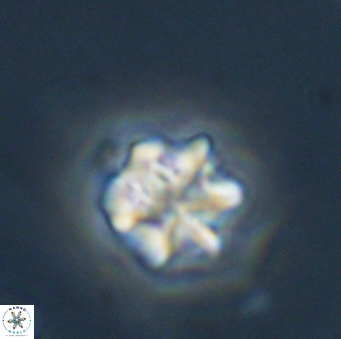 Olladiscoaster perplexus 32688