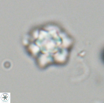 Olladiscoaster perplexus 32696