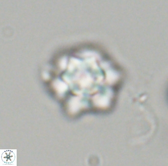 Olladiscoaster perplexus 32697