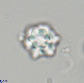 Olladiscoaster perplexus 32698