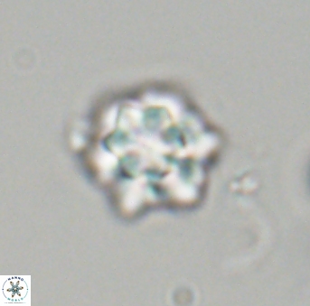 Olladiscoaster perplexus 32698