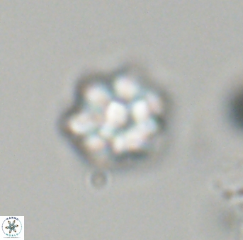 Olladiscoaster perplexus 32701