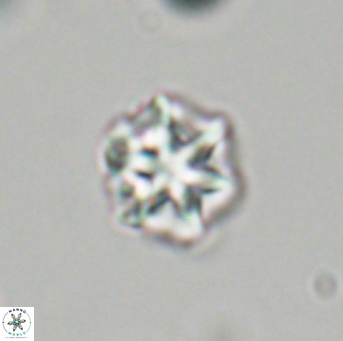 Olladiscoaster perplexus 32705