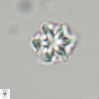 Olladiscoaster perplexus 32708