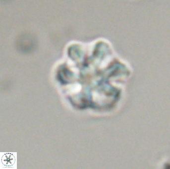 Olladiscoaster perplexus 32712
