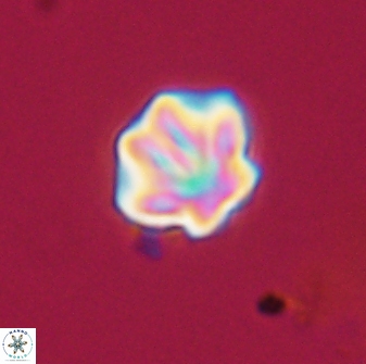 Olladiscoaster perplexus 32716