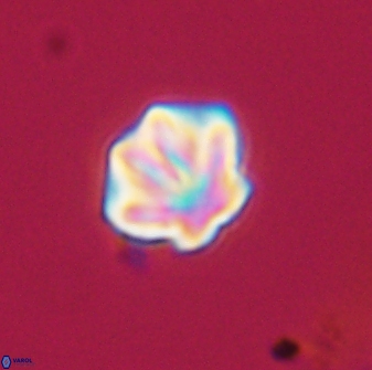 Olladiscoaster perplexus 32719