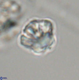 Olladiscoaster perplexus 32357