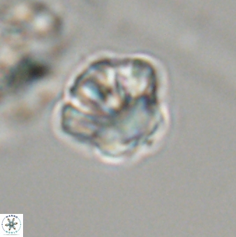 Olladiscoaster perplexus 32357