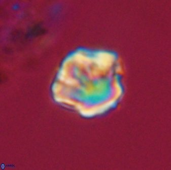 Olladiscoaster perplexus 32359