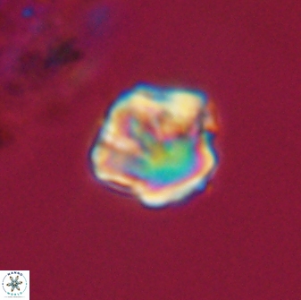 Olladiscoaster perplexus 32359