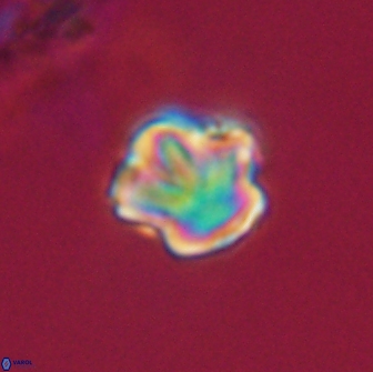 Olladiscoaster perplexus 32360