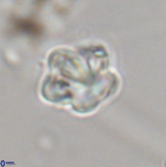 Olladiscoaster perplexus 32364