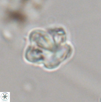 Olladiscoaster perplexus 32364