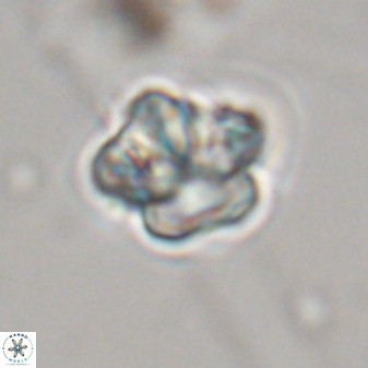 Olladiscoaster perplexus 32367