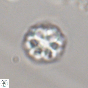 Olladiscoaster perplexus 32369