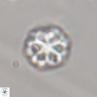 Olladiscoaster perplexus 32371