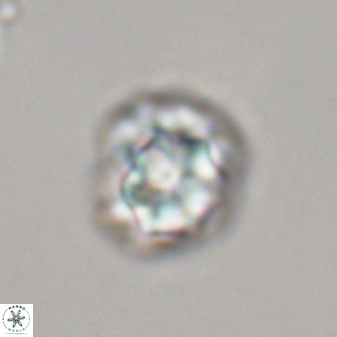 Olladiscoaster perplexus 32372