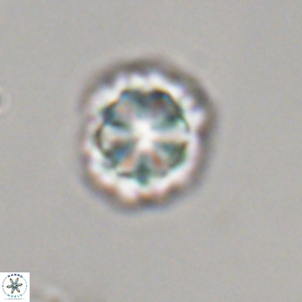 Olladiscoaster perplexus 32374