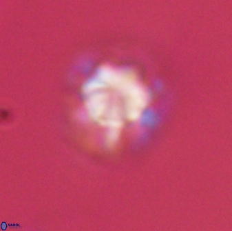 Olladiscoaster perplexus 32375