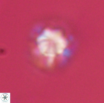 Olladiscoaster perplexus 32375