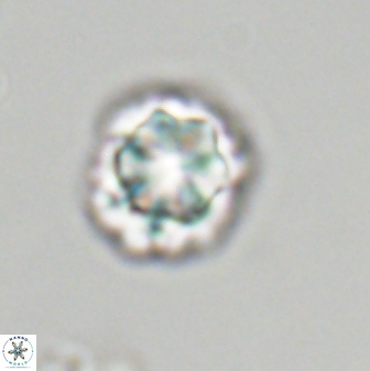 Olladiscoaster perplexus 32377