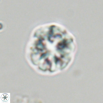 Olladiscoaster perplexus 32378
