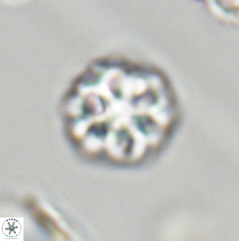 Olladiscoaster perplexus 32380