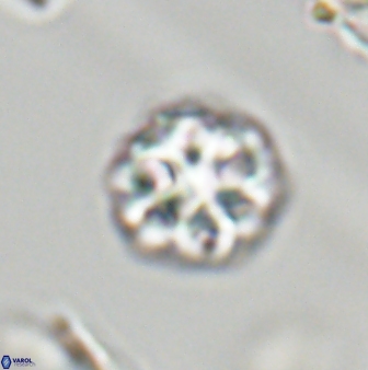 Olladiscoaster perplexus 32381