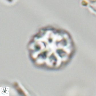 Olladiscoaster perplexus 32381