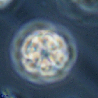 Olladiscoaster perplexus 32382