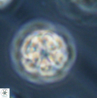Olladiscoaster perplexus 32382