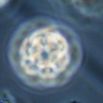 Olladiscoaster perplexus 32383