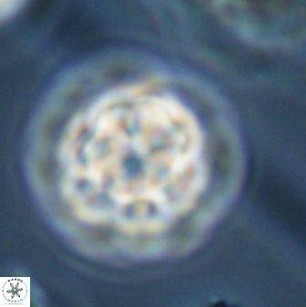 Olladiscoaster perplexus 32383