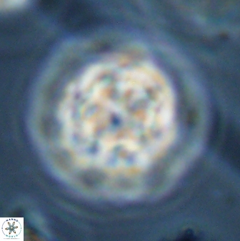 Olladiscoaster perplexus 32384