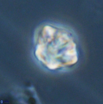 Olladiscoaster perplexus 32385